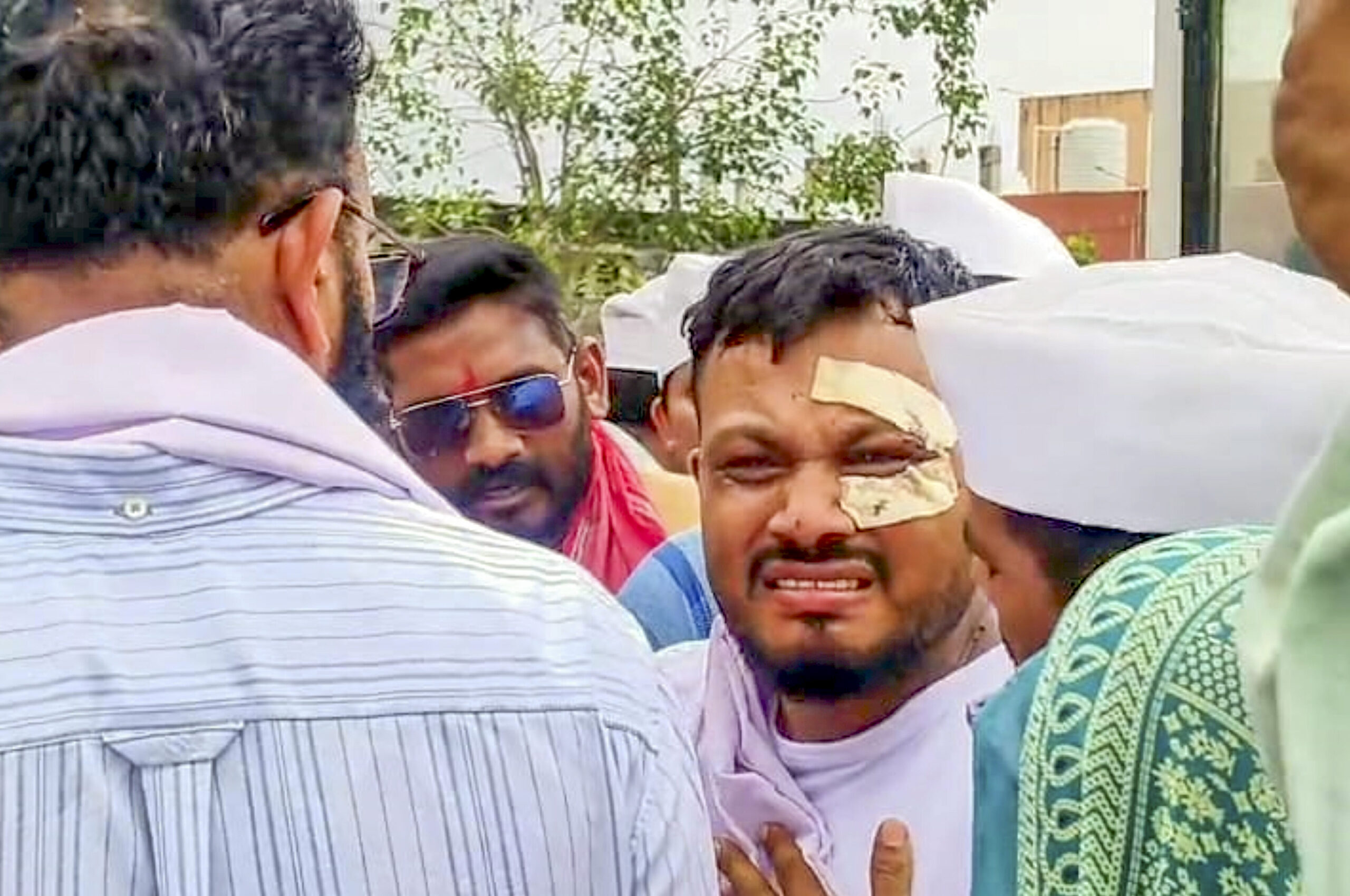 Sole survivor of Air India plane crash seeks psychiatric help to overcome trauma
